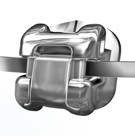 Brackets de autoligado Damon y personalizados