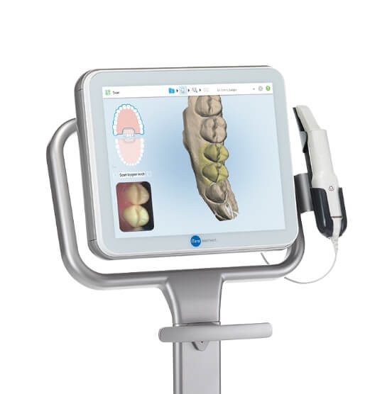 Scanner  3D intra oral Itero